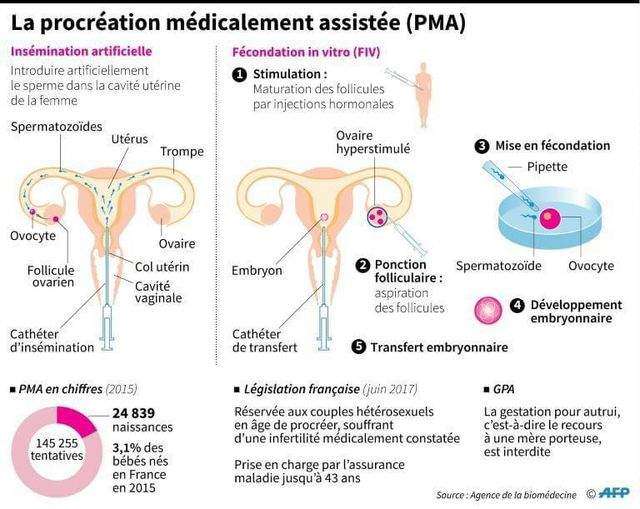 procréation médicalement assistée