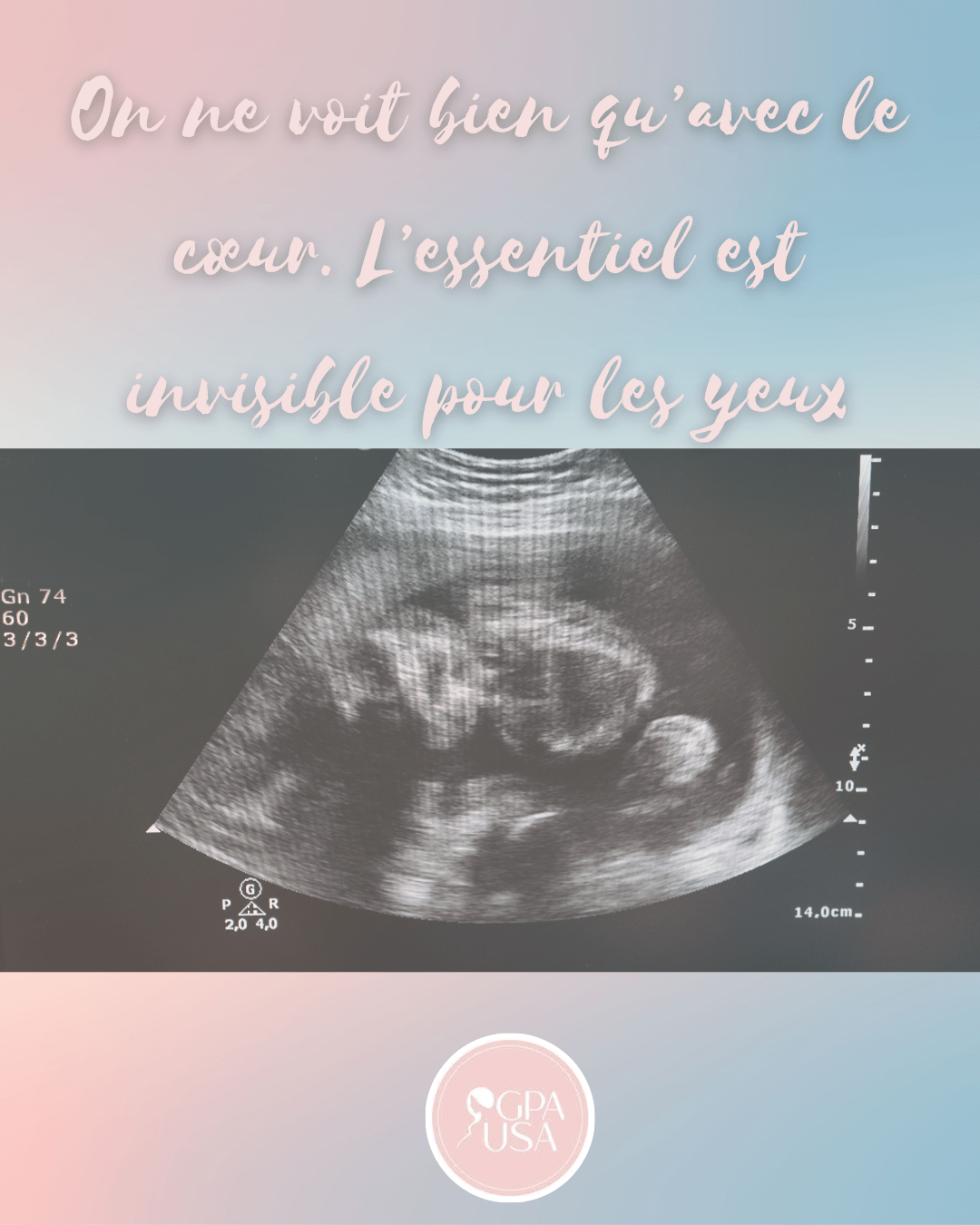 gestation pour autrui