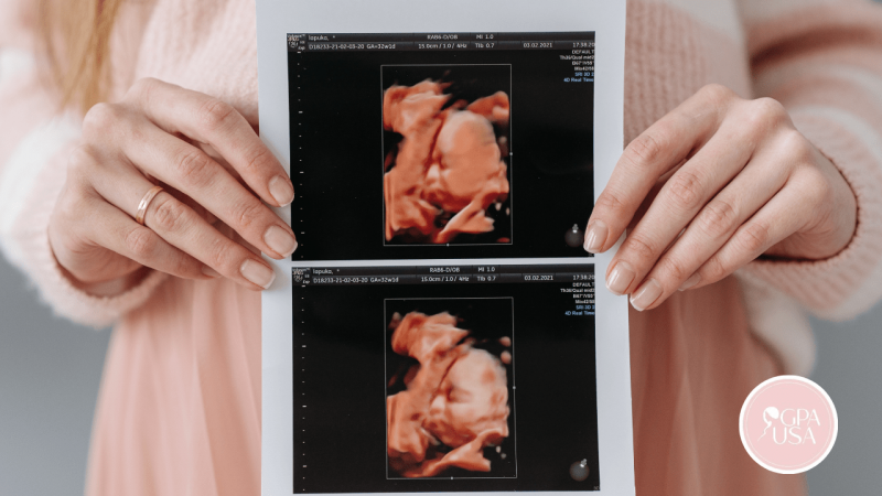gestation pour autrui